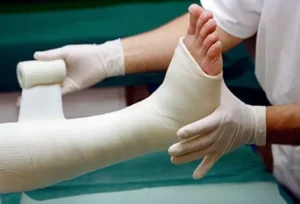 10 Amazing Facts About How Bones Heal After a Fracture