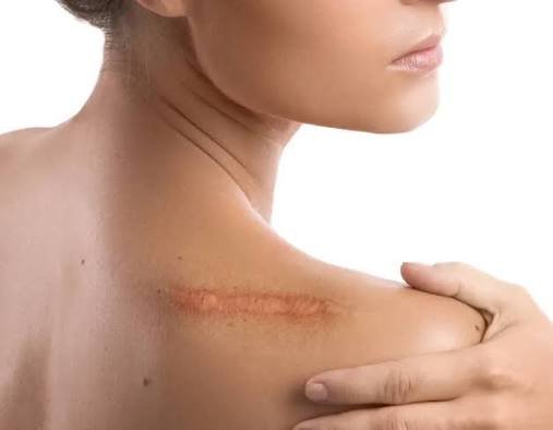 10 Interesting Facts About the Human Skin and Its Functions